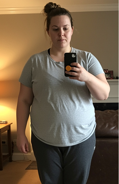 Second client-provided transformation photograph labeled before